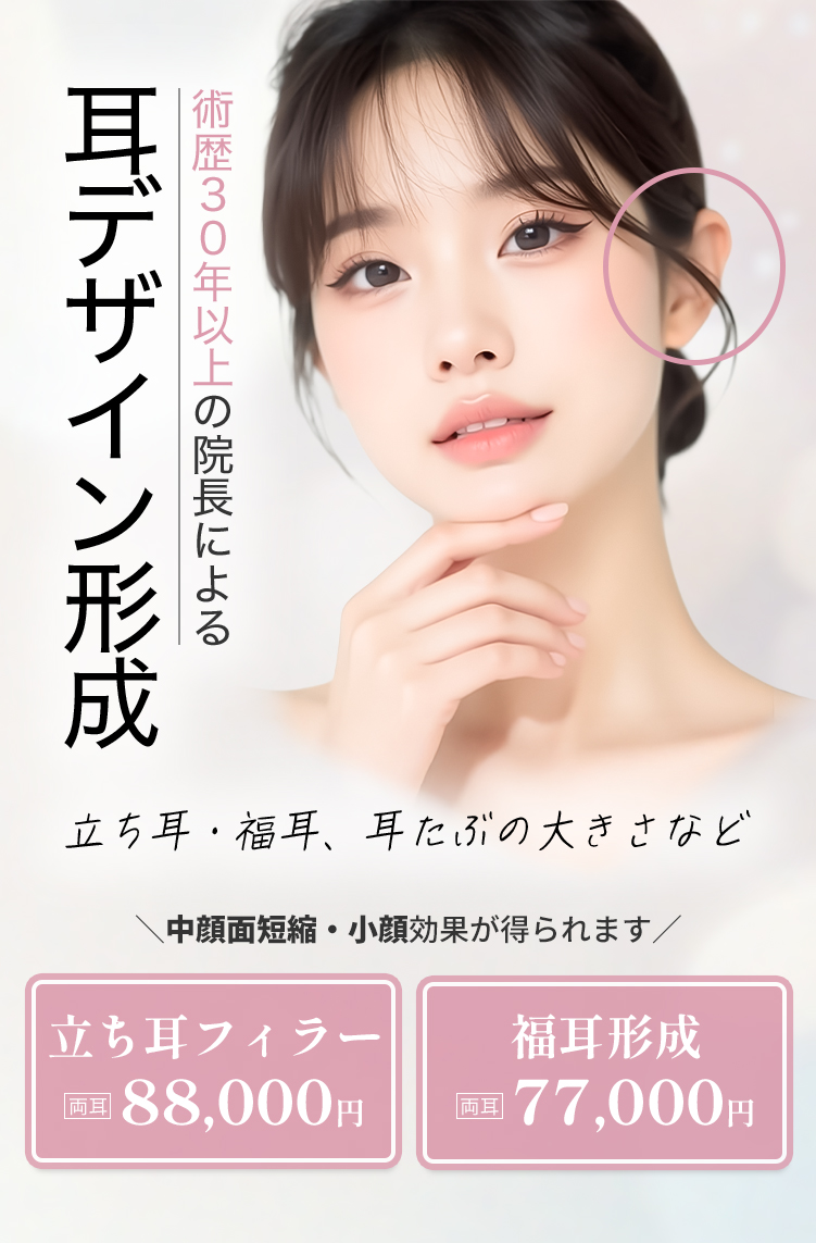 耳デザイン形成